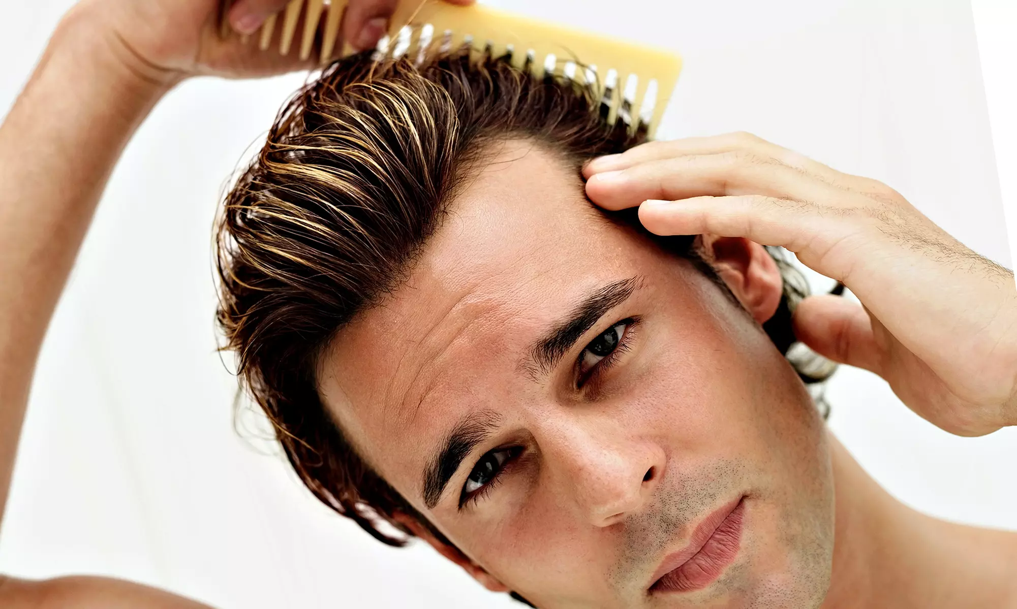 Boost Hair Growth & Transform Your Hair with One or Three PRP Hair Loss (Up to 50% Off) at Lov Med Spa - Primary Image