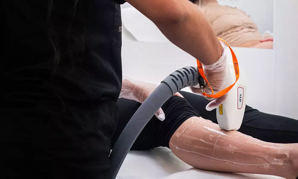 5 séances d'épilation laser sur une petite, moyenne ou grande zone