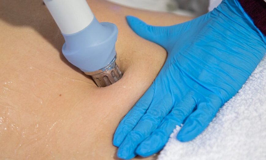 Image 2: 4, 6 u 8 sesiones de HIFU Liposonix para 1 persona