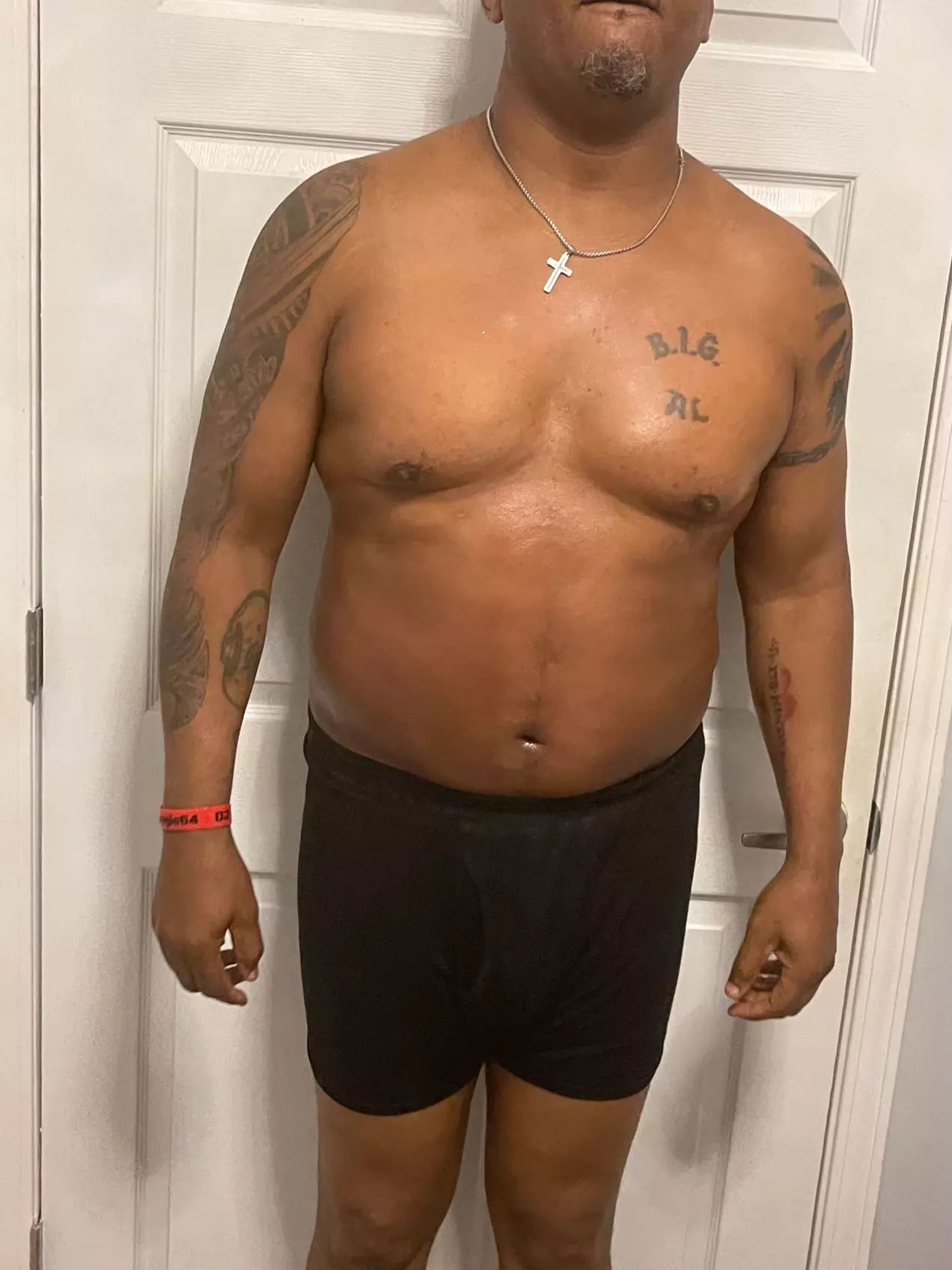 Up to 43% Off on Laser Lipo Treatments at Massage World Medspa