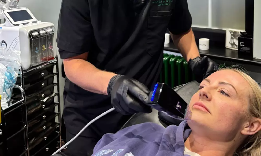 Microneedling with Derma 2.0: 1 or 3 Skin-Revitalising Sessions