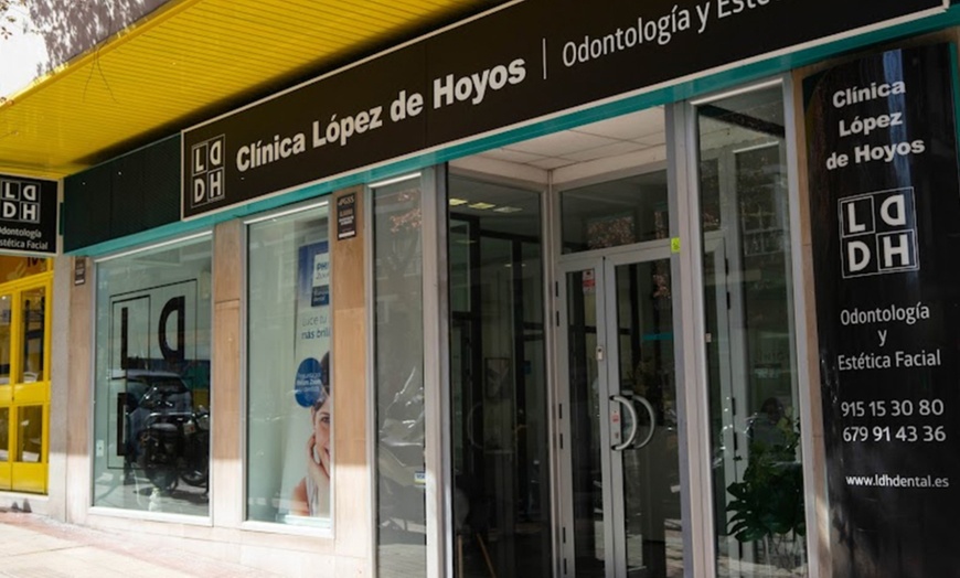 Image 4: Blanqueamiento dental led con limpieza y fluorización, 1 o 2 sesiones