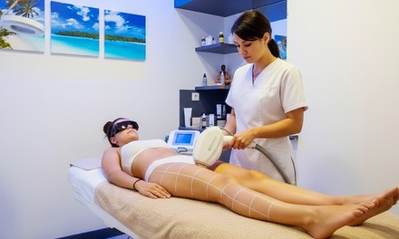 Depilación con láser diodo: 3 sesiones / Zona pequeña - Laser Beauty