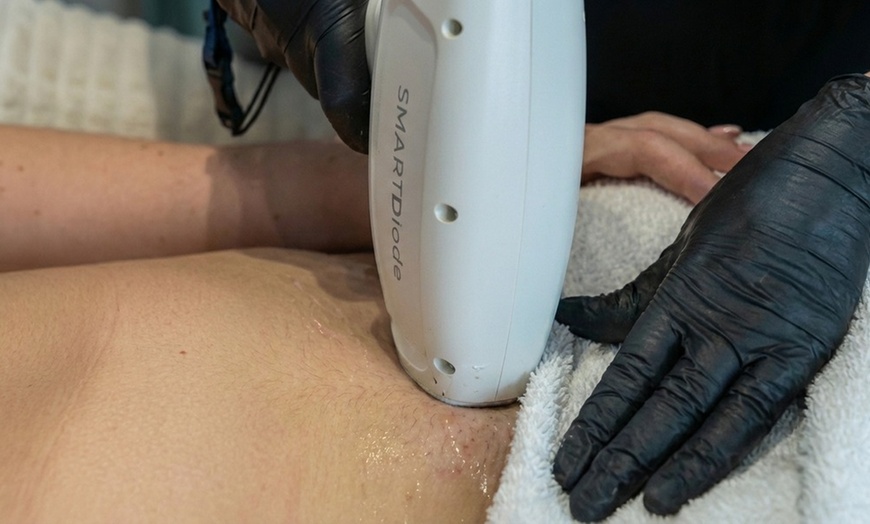 Image 4: 6 Laser Hair Removal Sessions on Small, Medium, or Large Area