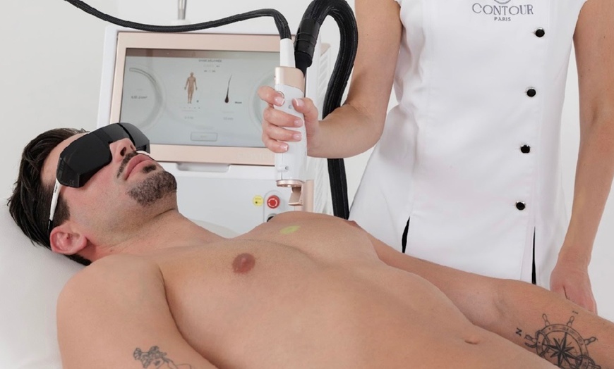 Image 2: 3 séances d'épilation laser pour femmes et hommes  