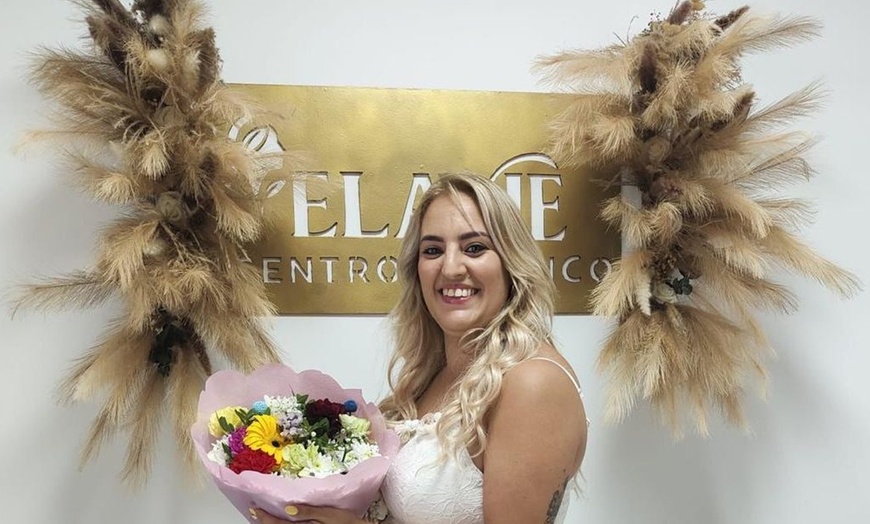 Image 8: Radiofrecuencia facial, cuello y escote con serum y masaje Kobido