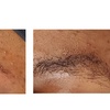 Image 2: Smooth Brows with One, Three, or Five Eyebrow Waxing
