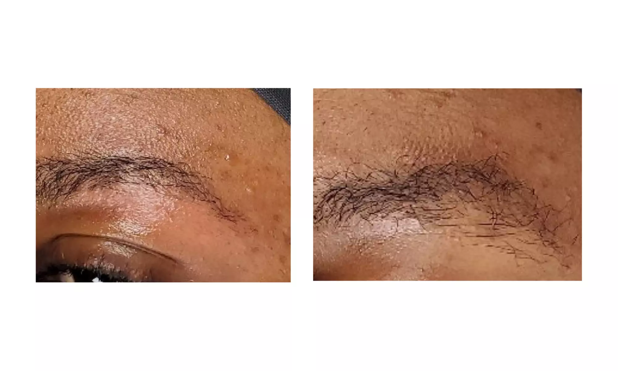 Smooth Brows with One, Three, or Five Eyebrow Waxing 