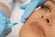 Tratamiento facial reafirmante inyectado con mesoterapia y/o retoque para 1 persona, con hasta un 62% de ahorro - Second Medium