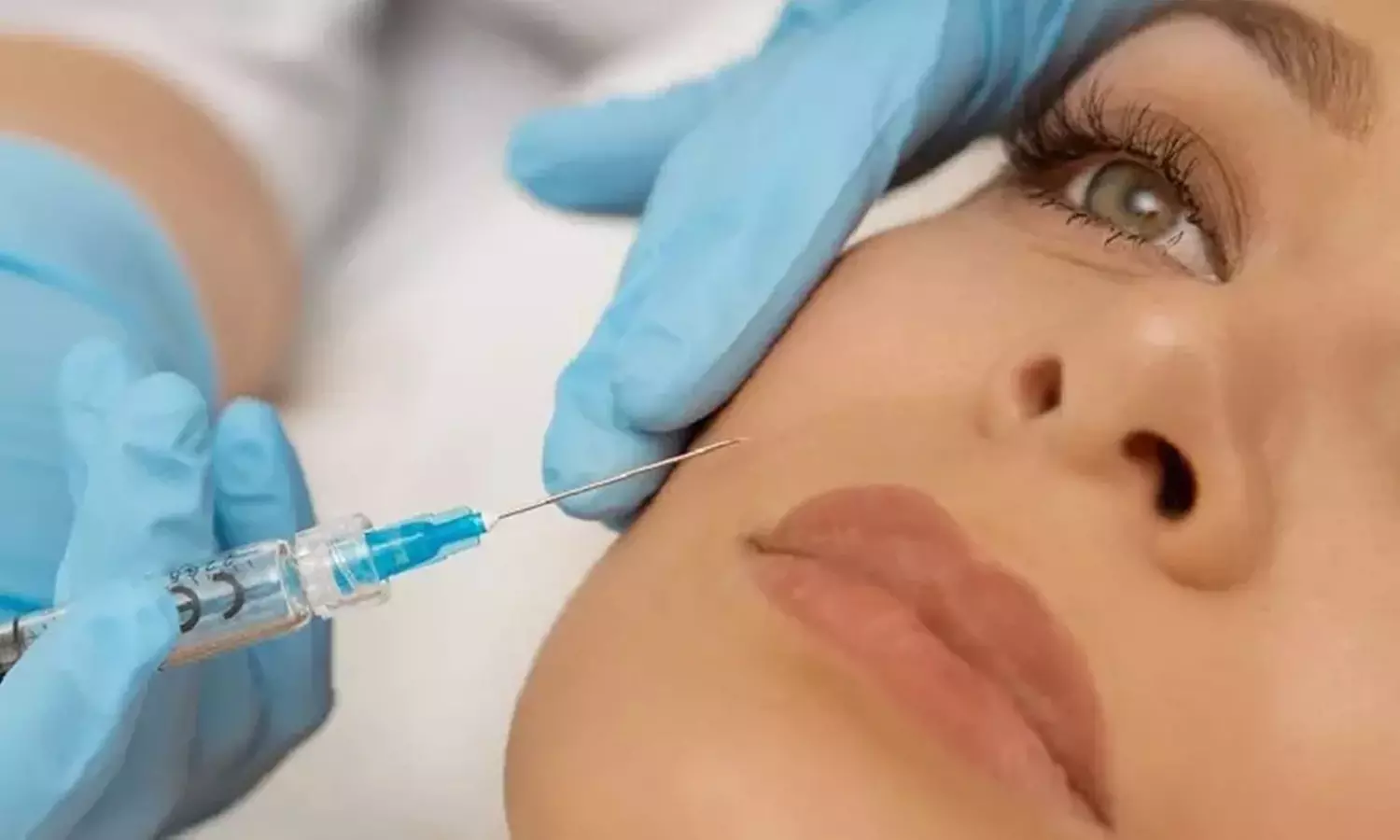 Tratamiento facial reafirmante inyectado con mesoterapia y/o retoque