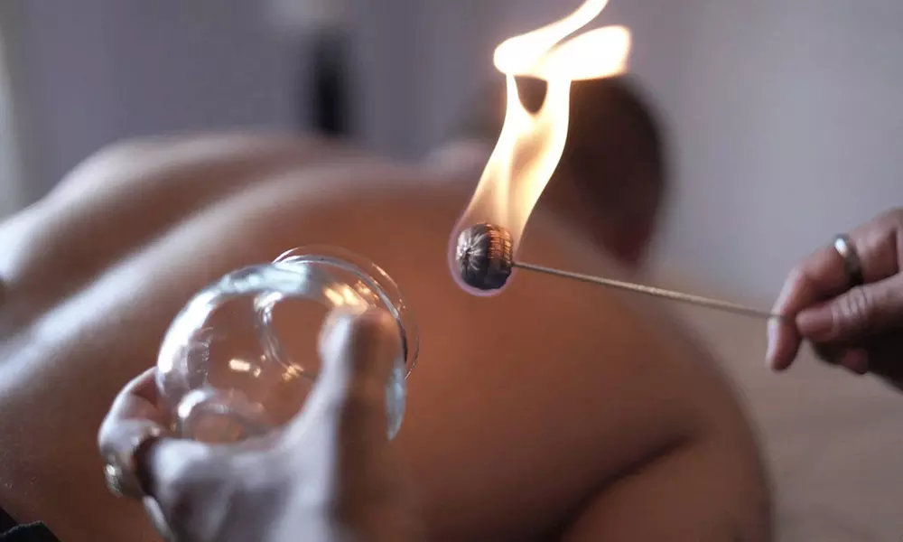 Revitalize With Acupuncture, Cupping, & Facial Rejuvenation Therapy