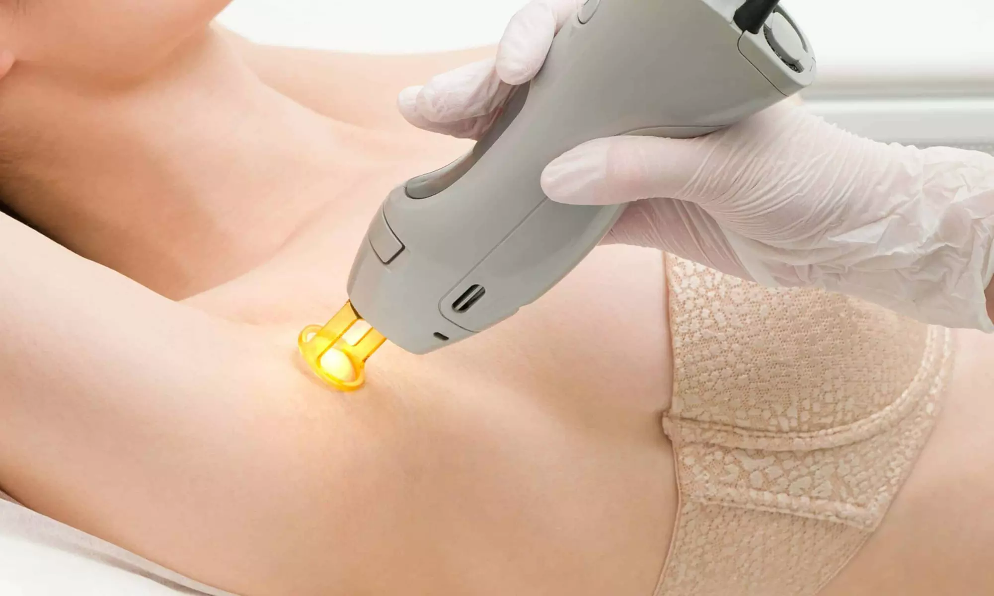 Épilation laser haut de gamme chez Golden Skin
