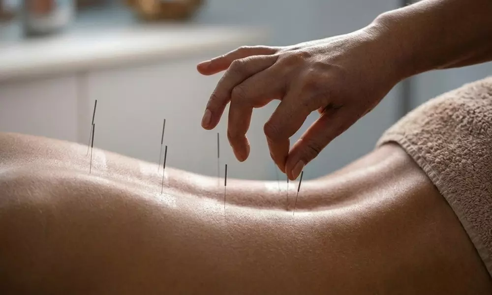 Sleep & Stress Acupuncture Sessions at Restorative Natural Medicine