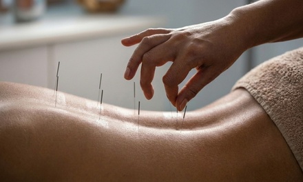 One 45 Min Sleep & Stress Acupuncture Session - Restorative Natural Medicine