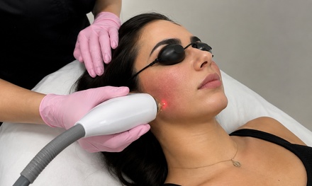 One Laser Skin Resurfacing Treatment - Lux Veritae Skin Spa