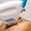 Image 2: Refresh w/ BBL IPL Photofacial Treatments for Face, Neck, & Décolleté