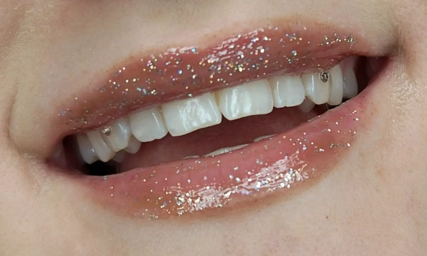 Biżuteria nazębna: kryształki w różnych wzorach i kolorach