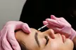 Up to 42% Off on Facial at APEX Performance & Aesthetics medical spa - Second Medium