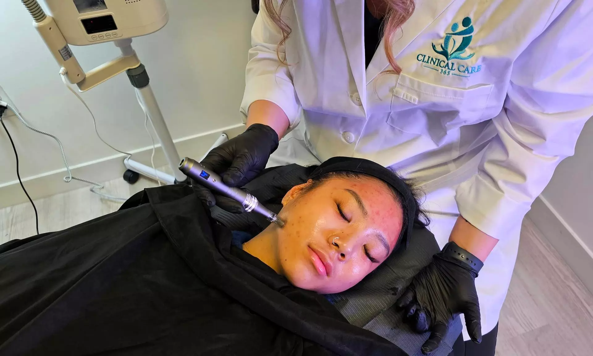 Rejuvenation Packages – 20, 40, or 60 Units of Botox
