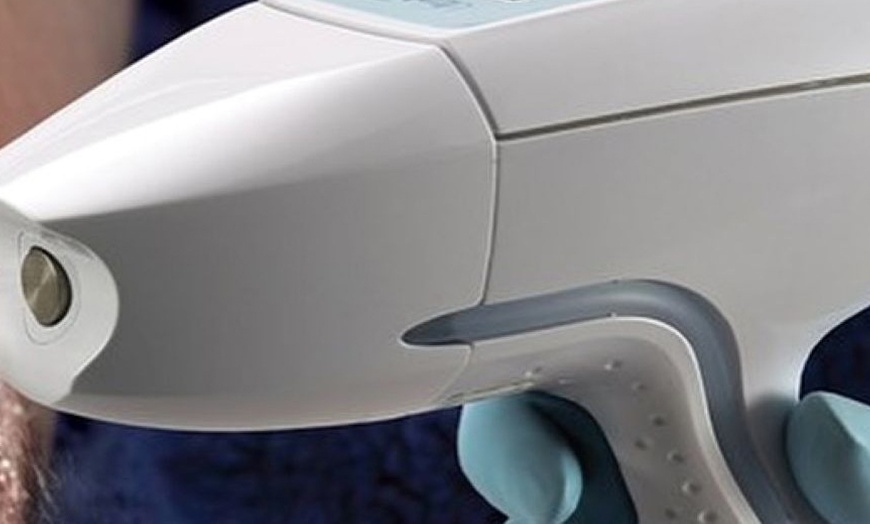 Image 3: Six Laser Hair Removal Sessions for Small, Medium, or Large Areas