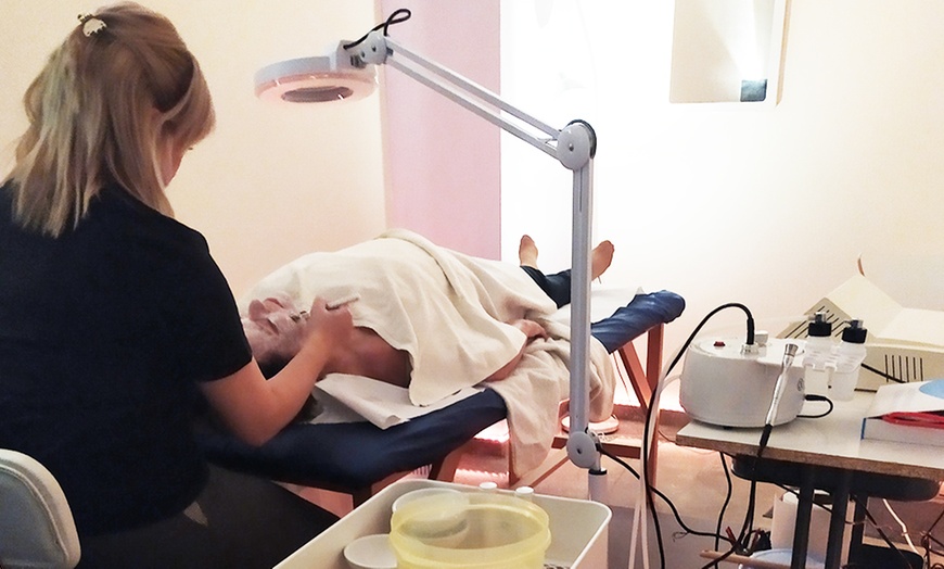 Image 16: 1 sesión de exososomas con Dermapen y opción a tratamiento adicional