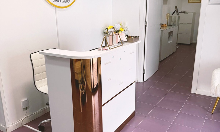 Image 17: Tratamiento de rejuvenecimiento facial con 10 o 20 hilos tensores PDO