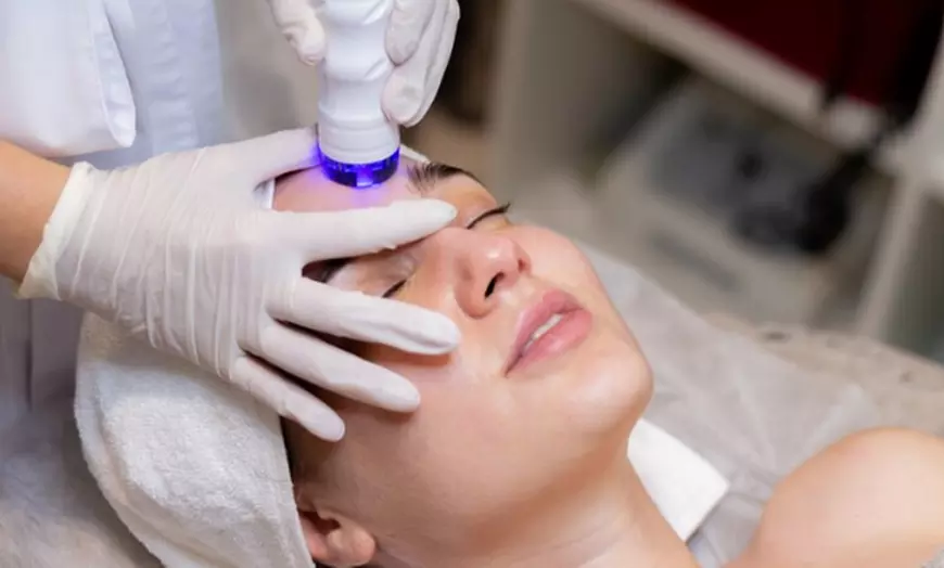 Image 1: 1, 2 o 3 sesiones de radiofrecuencia facial con opción a presoterapia 