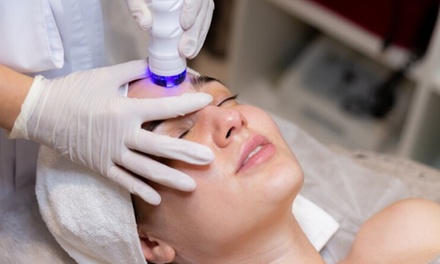 3 sesiones de radiofrecuencia facial de cara y cuello - Novaestetic Láser