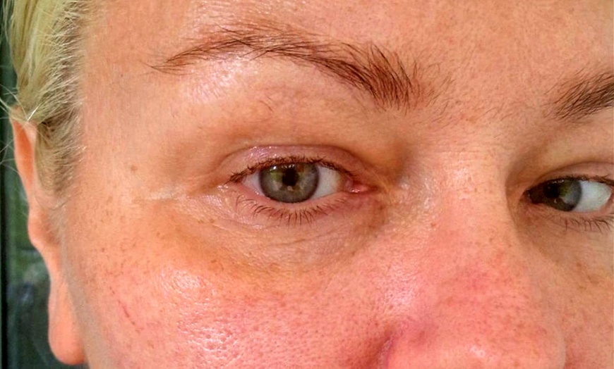 Image 3: Hydra Facial, Lumi Eyes, or Lumi Pro for a Radiant Glow!