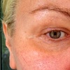 Image 3: Hydra Facial, Lumi Eyes, or Lumi Pro for a Radiant Glow!