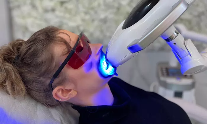 Strahlend weiße Zähne: 30 od. 60 Min. Zahn-Bleaching-Paket für 1 Pers.