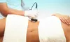 Transform with 3, 6 or 10 Ultrasonic-Cavitation Sessions at Harmony Body Studio (Up to 55% Off)