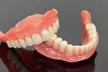 Prótesis Dental Acrílica completa en 1 o 2 arcadas con colocación, valoración y diseño para 1 persona al53% - Second Medium