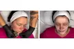 Transform Skin @Silk Co Aesthetics :1, 3, or 5 Sessions(60 Mins) Choice of Silk Facial (Up to 74% Off) - Second Medium
