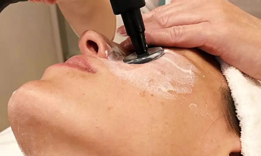 1, 2 o 4 sesiones de radiofrecuencia facial o corporal con masaje