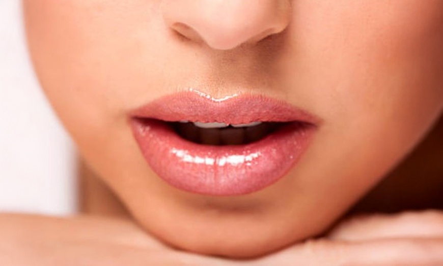 Image 1: Tratamiento de relleno para labios con 1 o 2 viales