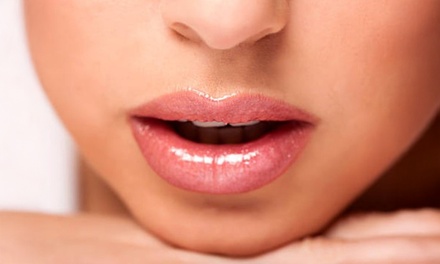 1 vial de relleno dérmico para labios - Clínica medico estética Marchesi