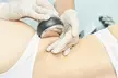 CryoLipo Fat Freezing Session & Consultation w/w/o EMS Toning Sessionat CryoSculpt Body Lab (Up to 50% Off) - Image 4