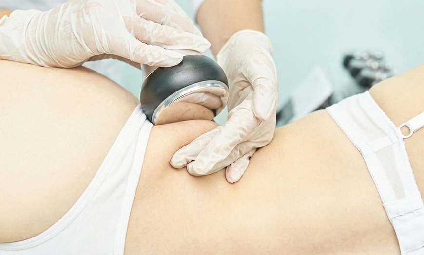 Image 4: CryoLipo Fat Freezing Session & Consultation w/w/o EMS Toning Session
