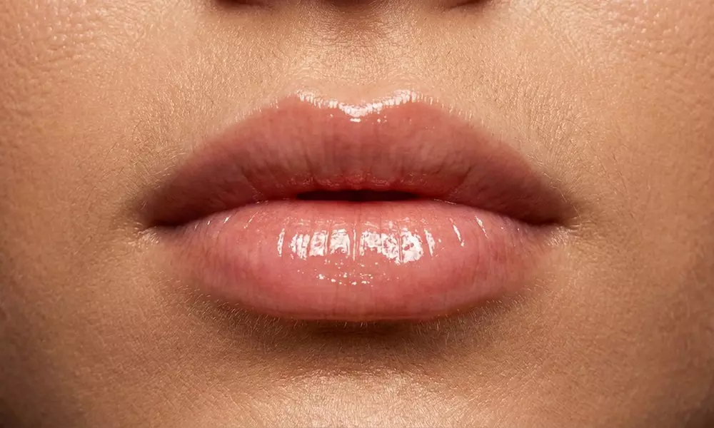 Achieve Natural-Looking Fullness with Half Syringe Restylane Kysse Lip Filler & Free Consultation(Up to 30% Off)