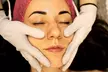 Transform with  1x, 3x, or 5x RF Micro-Needling Facial (60-Min) at Beauty Wellness CHI (Up to 97% Off) - Second Medium