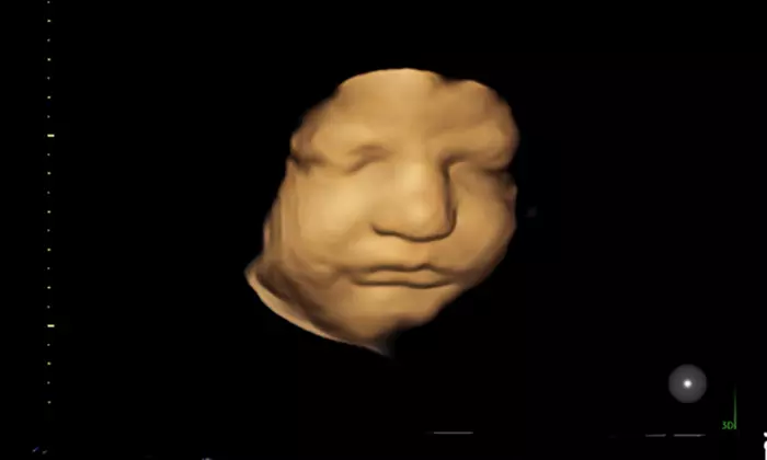 Capture Baby's First Moments with 3D/4D Ultrasound