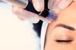 Limpieza facial con opción a tratamiento renovador, antiarrugas, hydralips, relleno y más para 1, al 66% - Second Medium