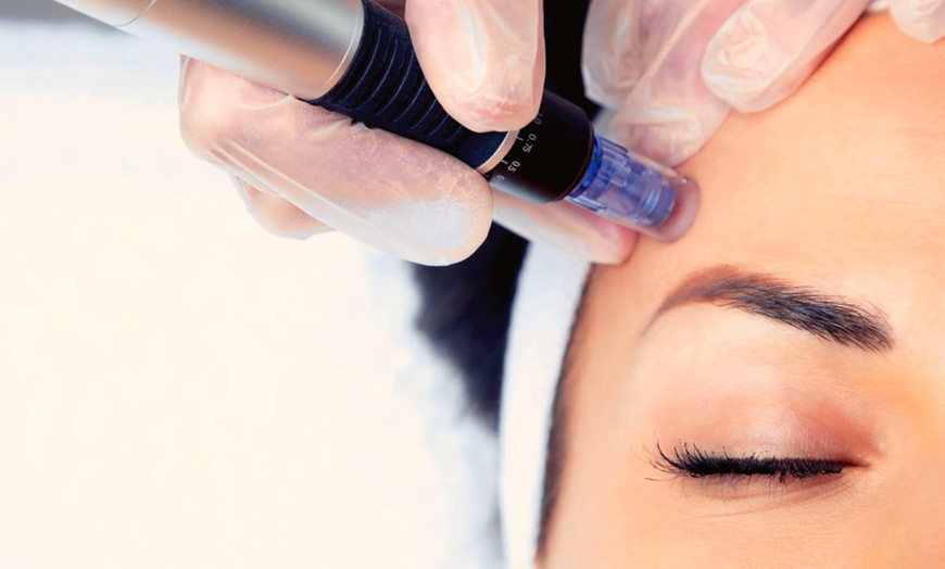 Image 2: Limpieza facial con tratamiento antiarrugas, hydralips, relleno y más