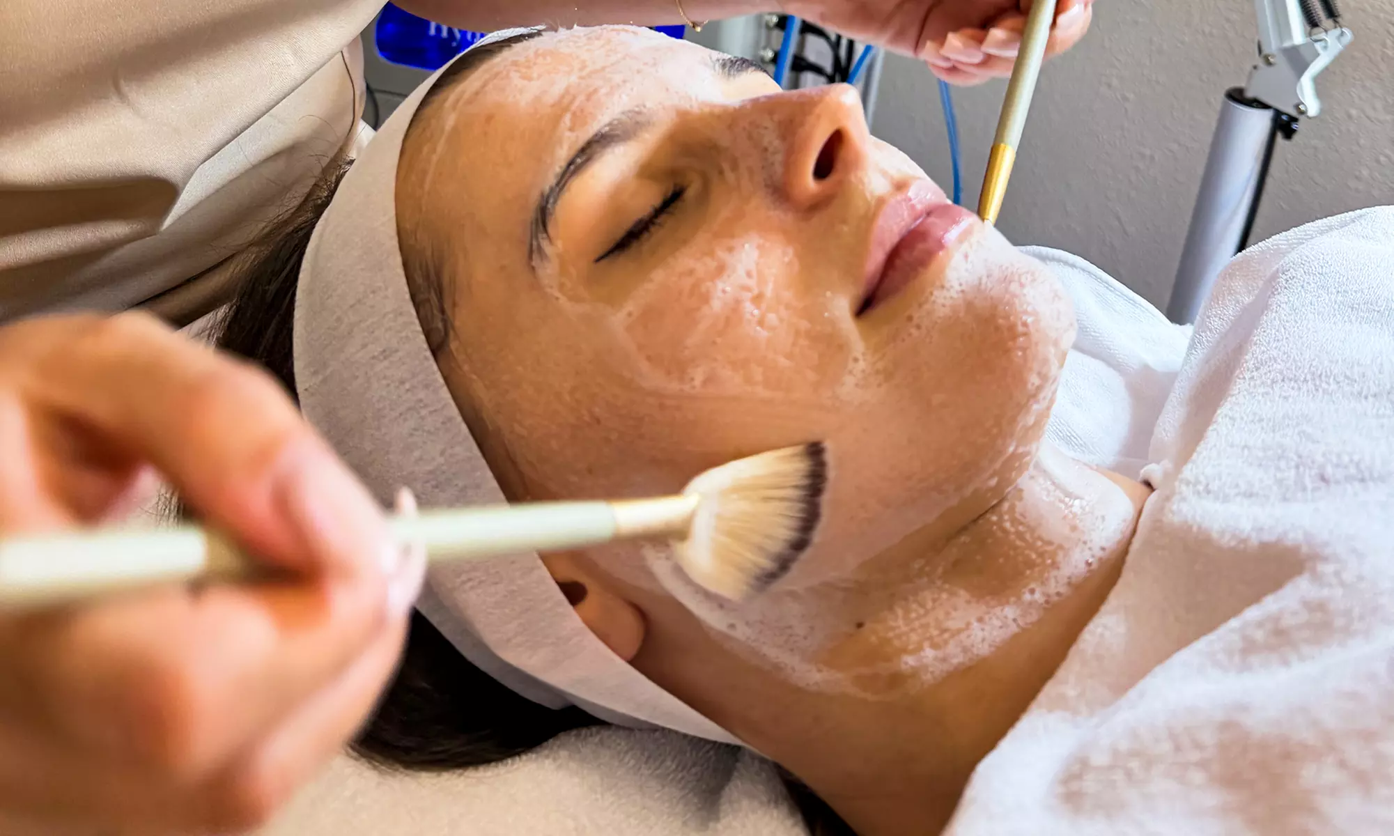 Transform Your Skin with 90-Minute Micro-Needling Sessions