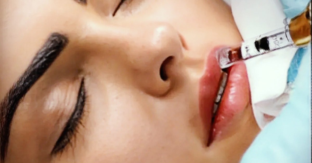 Tratamiento facial y limpieza de piel en Granada