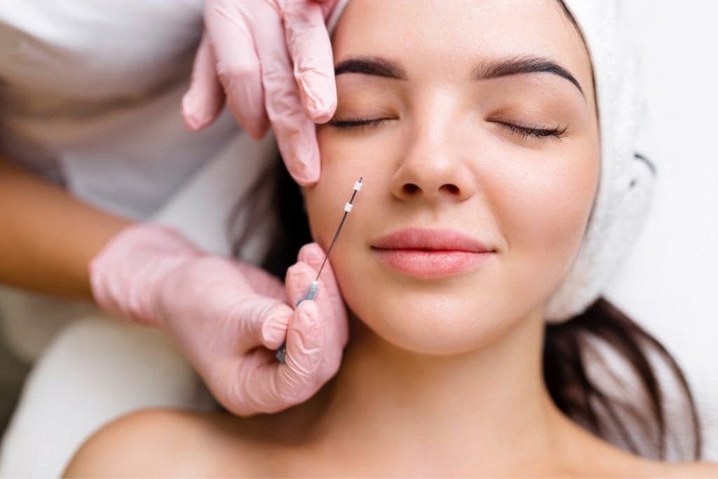 Enhance Your Contours with One or Two PDO Threads Facelift