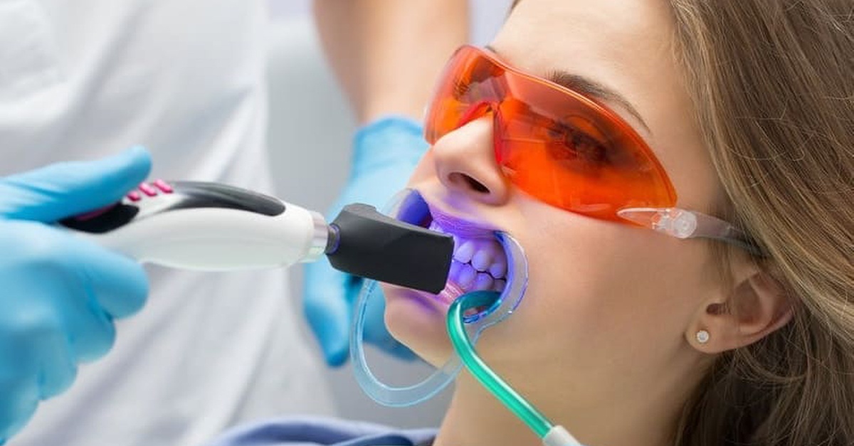 Limpieza dental y blanqueamiento LED con diagnóstico dental en Zaragoza