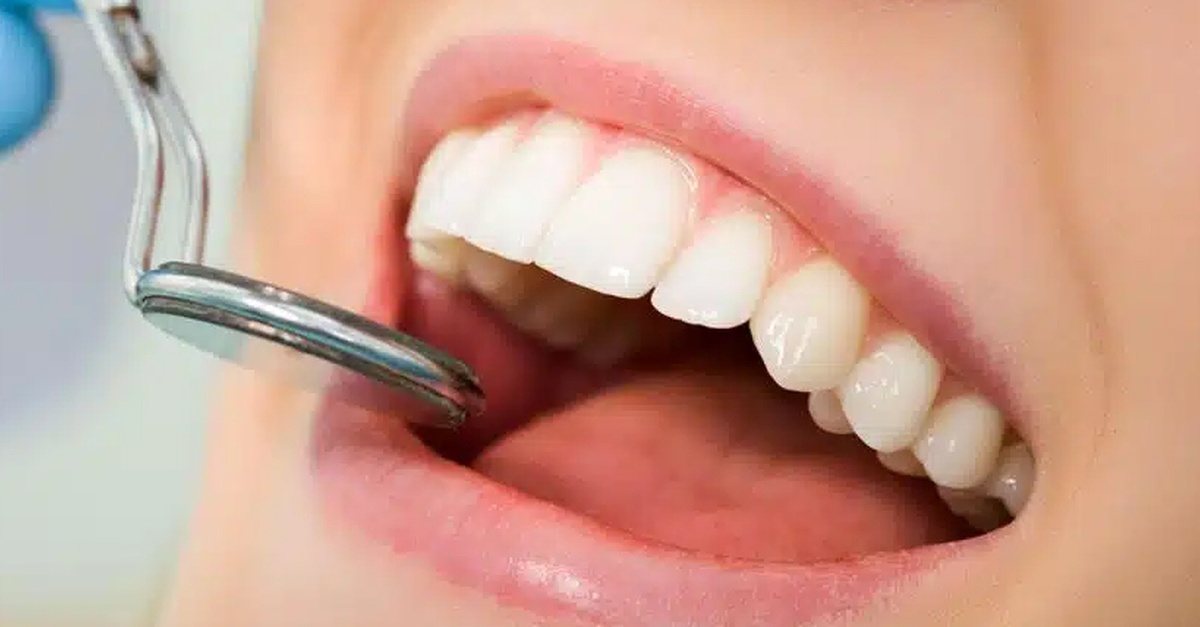 Limpieza bucal y diagnóstico periodontal en Barcelona