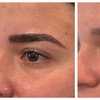 Image 5: Eyebrow Microblading and Touch-Up for Perfect Brows